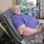 A burden on the heart: the sad story of one of the fattest people in the world