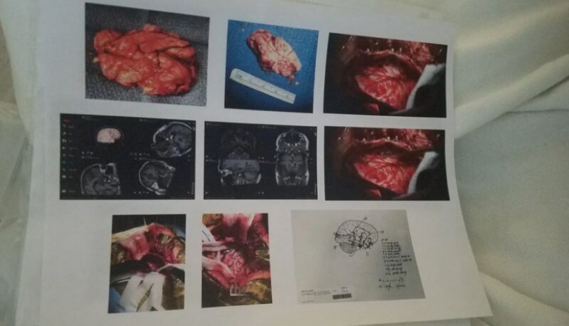 A life without fear: an American made brave by forced brain surgery