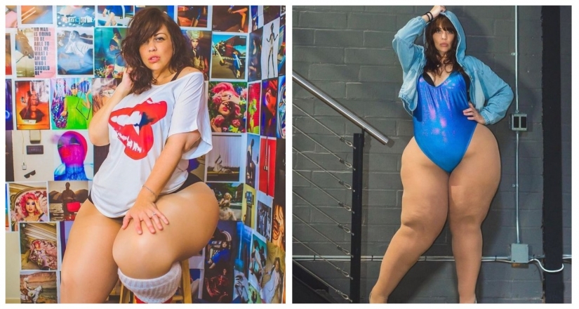 A model with a lipedema inspires others not to be ashamed of their body