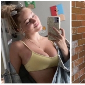 A mountain off her shoulders: an 18-year-old American woman told how her life has improved after breast reduction