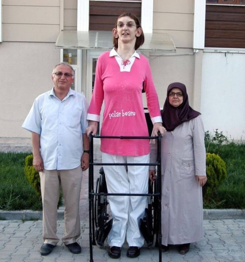 A resident of Turkey has officially become the tallest woman in the world A resident of Turkey has officially become the tallest woman in the world