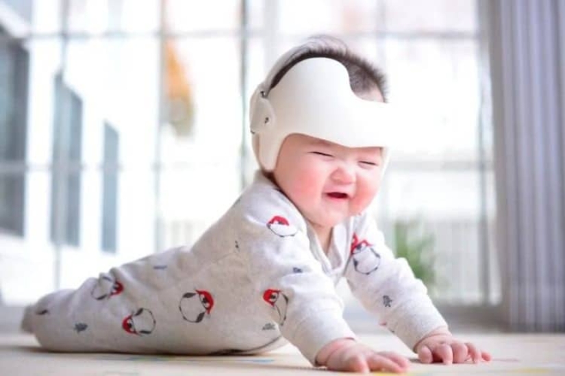 A strange Chinese novelty - a helmet for correcting the shape of the head in newborns A strange Chinese novelty - a helmet for correcting the shape of the head in newborns