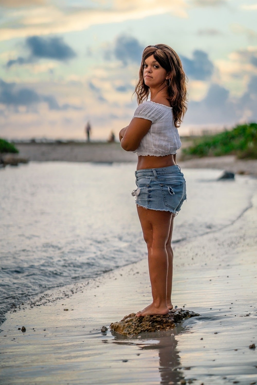 A través del dolor - a un sueño: un enano americano se sometió a operaciones complejas durante muchos años para crecer A través del dolor - a un sueño: un enano americano se sometió a operaciones complejas durante muchos años para crecer