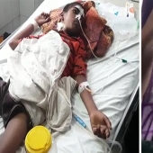 A young Indian ate toothbrushes and nails to cure addiction