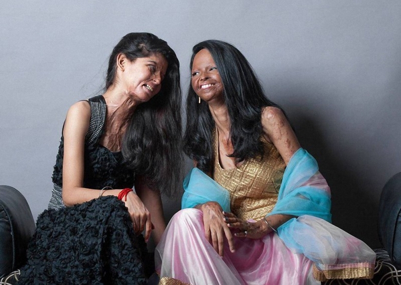 Acid mutilated models from India