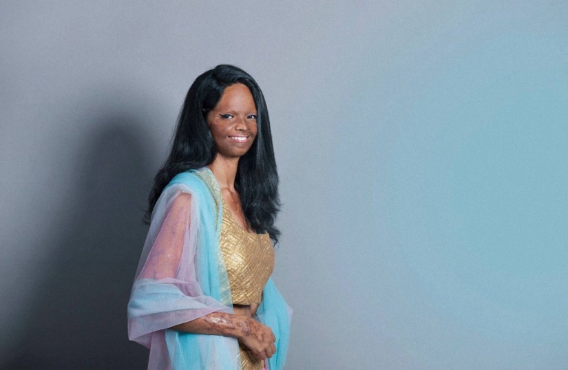 Acid mutilated models from India