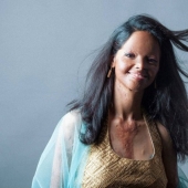 Acid mutilated models from India