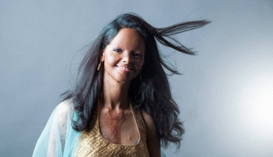 Acid mutilated models from India