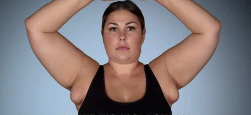 After giving birth, the American woman grew "breasts" under her arms, from which milk oozed