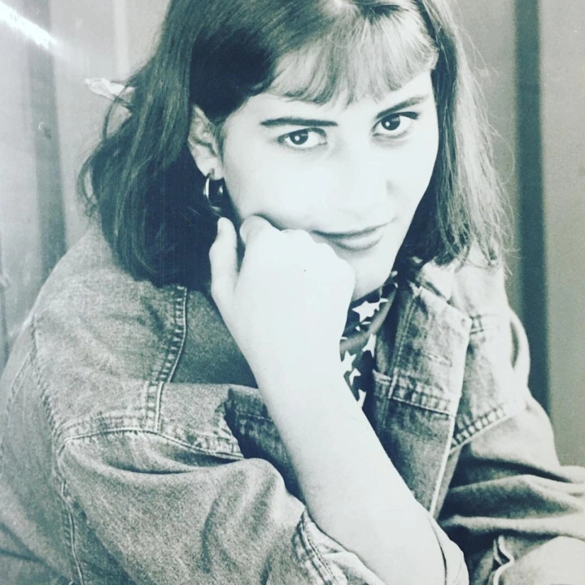 Beauty, no matter what: a Brazilian woman with a rare disease admires self-confidence