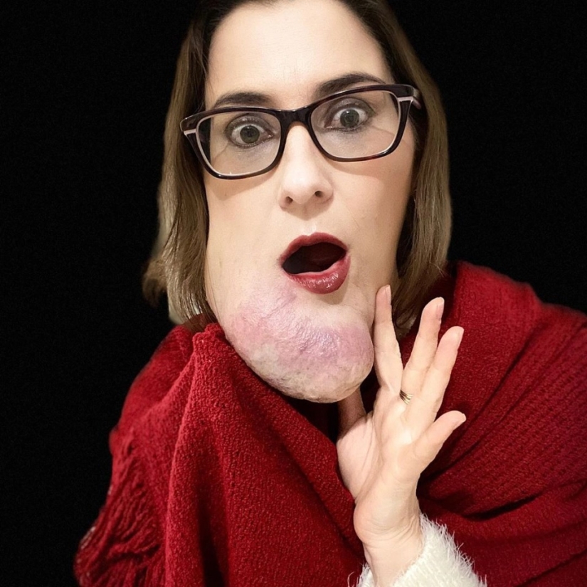 Beauty, no matter what: a Brazilian woman with a rare disease admires self-confidence