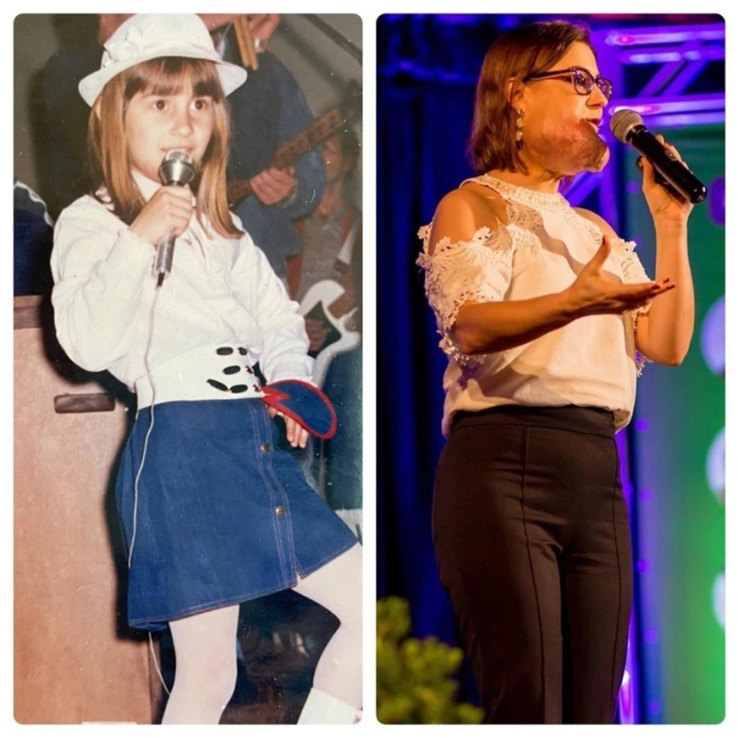 Beauty, no matter what: a Brazilian woman with a rare disease admires self-confidence