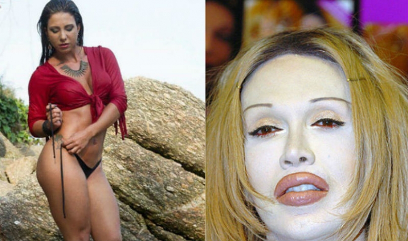 Beauty requires: 8 victims of plastic surgery Beauty requires: 8 victims of plastic surgery