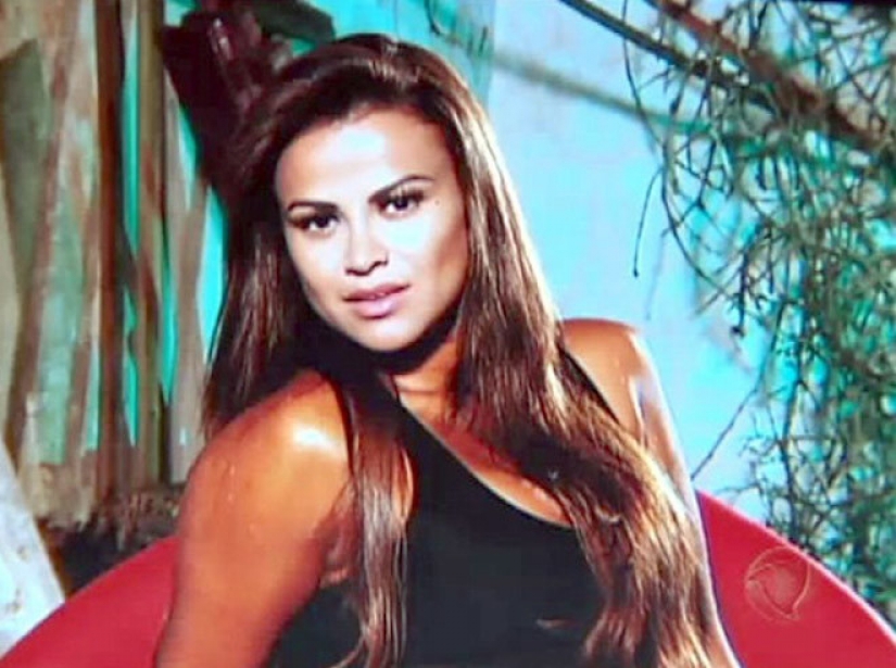 Beauty requires: 8 victims of plastic surgery Beauty requires: 8 victims of plastic surgery