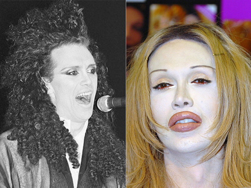 Beauty requires: 8 victims of plastic surgery Beauty requires: 8 victims of plastic surgery