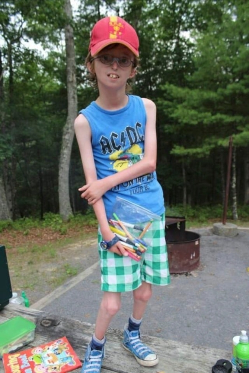 Being who you are: A guy from Scotland with a rare disease inspires others Being who you are: A guy from Scotland with a rare disease inspires others