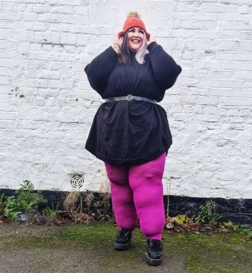 British woman exhausted herself with diets to make her legs lose weight, but it was a disease British woman exhausted herself with diets to make her legs lose weight, but it was a disease
