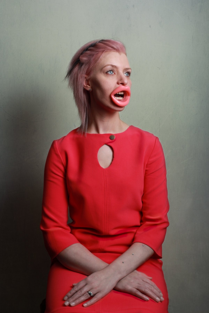 Clothespin on the nose and duck lips: what women are ready for for the sake of beauty and youth