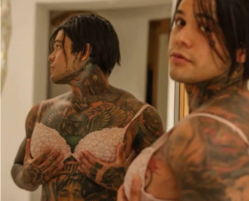 Columbian blogger lost a bet and made themselves silicone breast