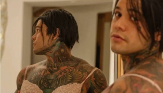 Columbian blogger lost a bet and made themselves silicone breast