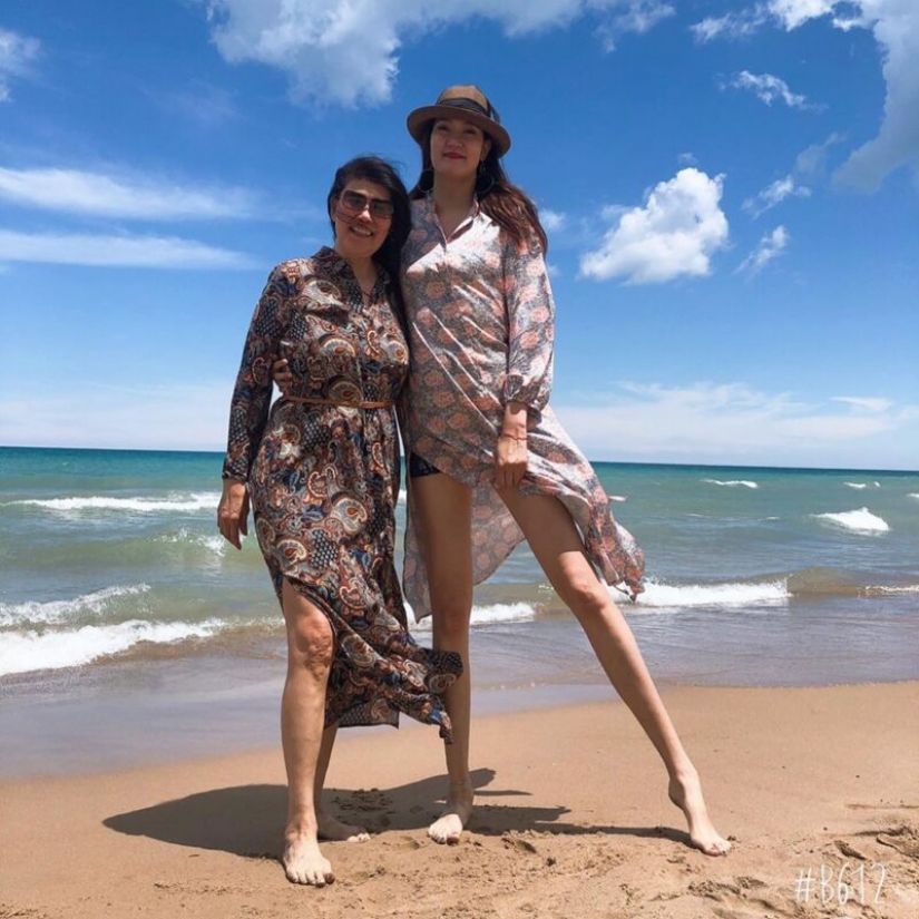 Como Renee se ve mal, el dueño de las piernas más largas del mundo Como Renee se ve mal, el dueño de las piernas más largas del mundo