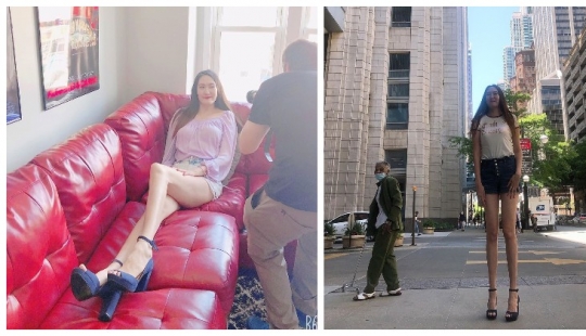 Como Renee se ve mal, el dueño de las piernas más largas del mundo Como Renee se ve mal, el dueño de las piernas más largas del mundo