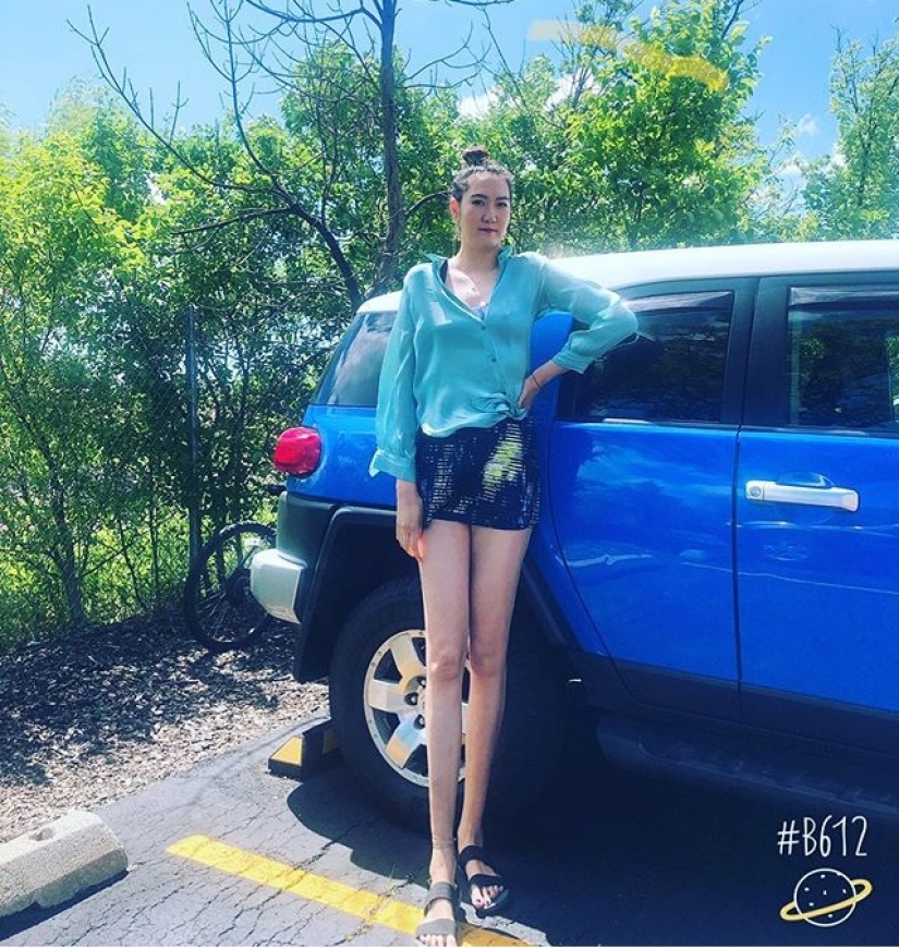 Como Renee se ve mal, el dueño de las piernas más largas del mundo Como Renee se ve mal, el dueño de las piernas más largas del mundo