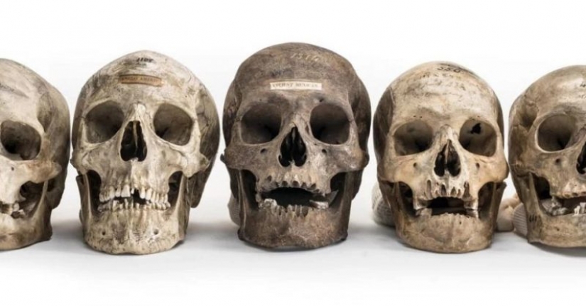 Count of bone? On the black market Instagram appeared human remains