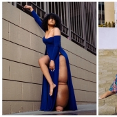 "Cut off your leg!": how an American woman with a 45-kilogram limb learned to love herself