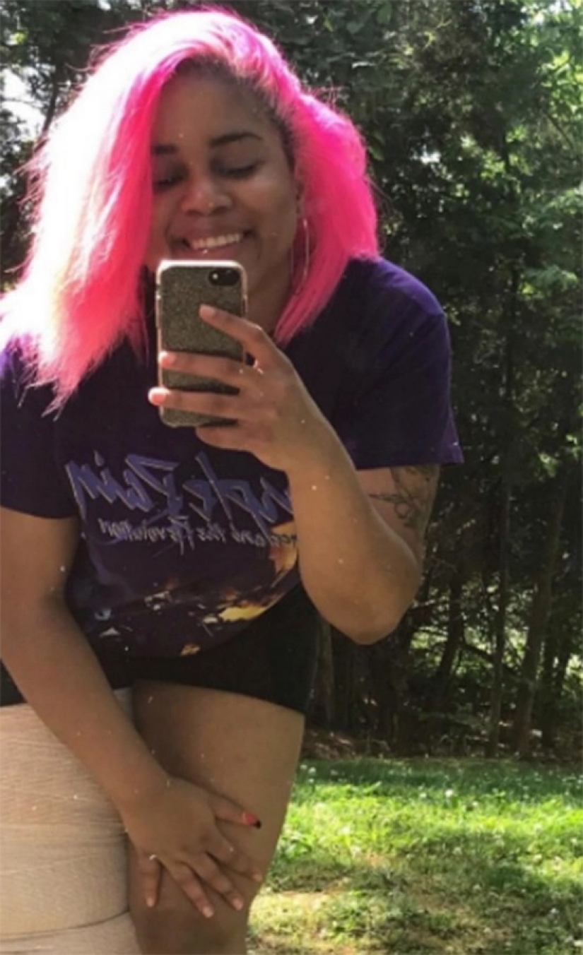 "Cut off your leg!": how an American woman with a 45-kilogram limb learned to love herself