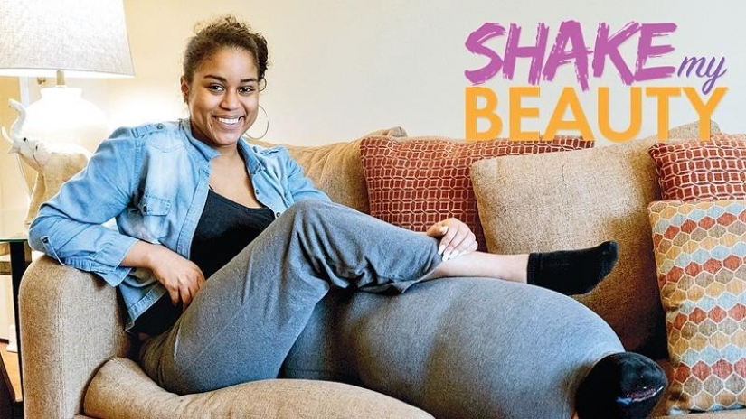 "Cut off your leg!": how an American woman with a 45-kilogram limb learned to love herself