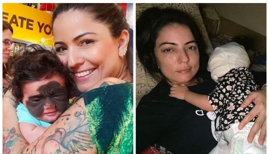 De Batman a Princesa: los médicos rusos eliminaron una enorme marca de nacimiento de la cara de una mujer estadounidense de 2 años De Batman a Princesa: los médicos rusos eliminaron una enorme marca de nacimiento de la cara de una mujer estadounidense de 2 años