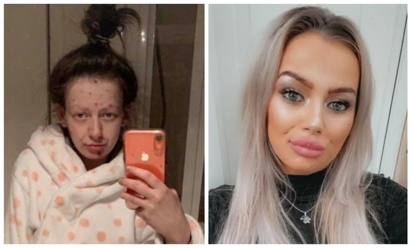 De una rana a una princesa: una ex drogadicta se convirtió en una belleza, librándose de la adicción