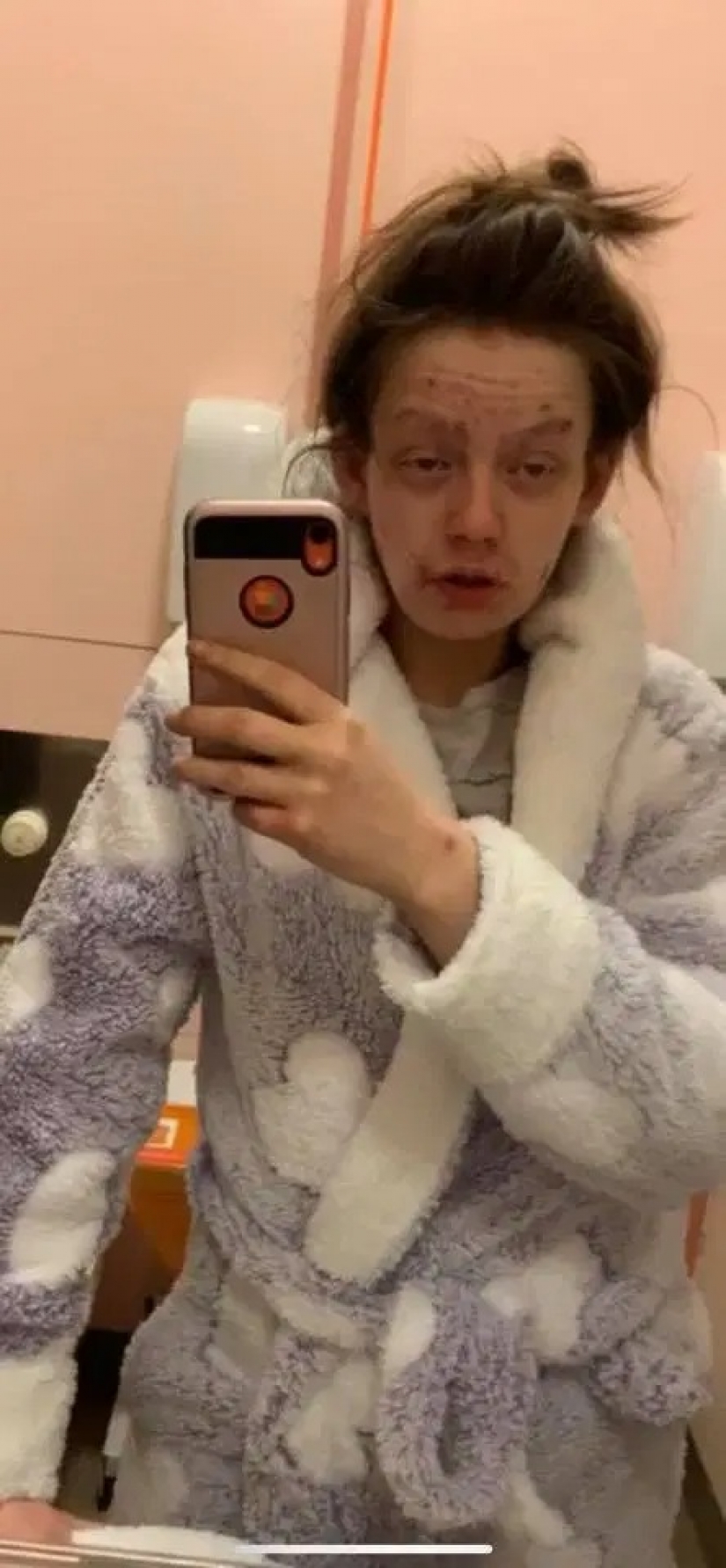 De una rana a una princesa: una ex drogadicta se convirtió en una belleza, librándose de la adicción