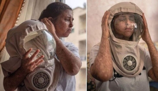 Debido a una rara alergia al sol, una mujer de Marruecos camina en un traje espacial Debido a una rara alergia al sol, una mujer de Marruecos camina en un traje espacial