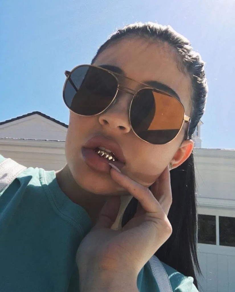 Diamond teeth: stars boast grizli of gold and precious stones