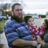 Difficult choice: parents from the United States are afraid to make a decision about the separation of Siamese twins