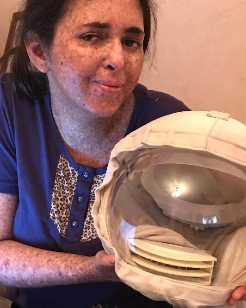Due to a rare allergy to the sun, a woman from Morocco walks in a spacesuit Due to a rare allergy to the sun, a woman from Morocco walks in a spacesuit