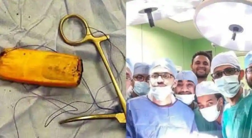 Egyptian doctors took out a mobile phone from the patient's intestines, which had been there for six months Egyptian doctors took out a mobile phone from the patient's intestines, which had been there for six months