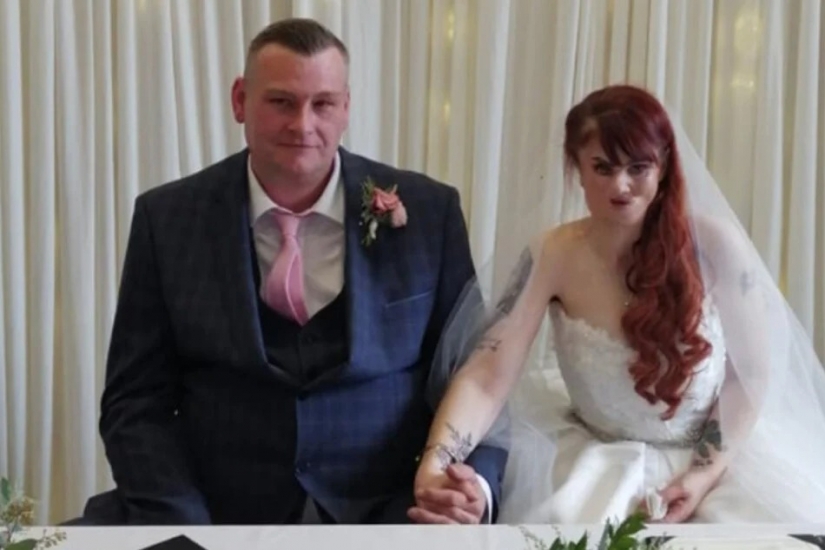 El amor mira al corazón: cómo una mujer irlandesa con el rostro desfigurado encontró su felicidad femenina