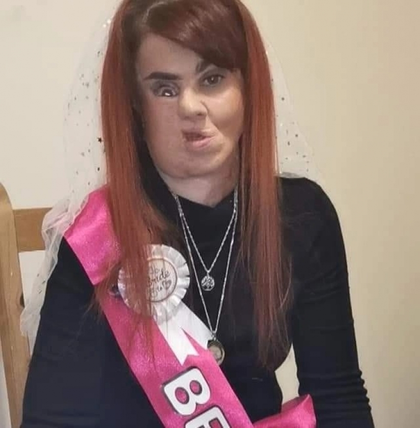 El amor mira al corazón: cómo una mujer irlandesa con el rostro desfigurado encontró su felicidad femenina