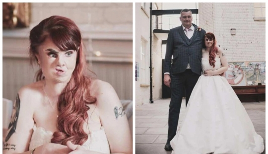 El amor mira al corazón: cómo una mujer irlandesa con el rostro desfigurado encontró su felicidad femenina El amor mira al corazón: cómo una mujer irlandesa con el rostro desfigurado encontró su felicidad femenina