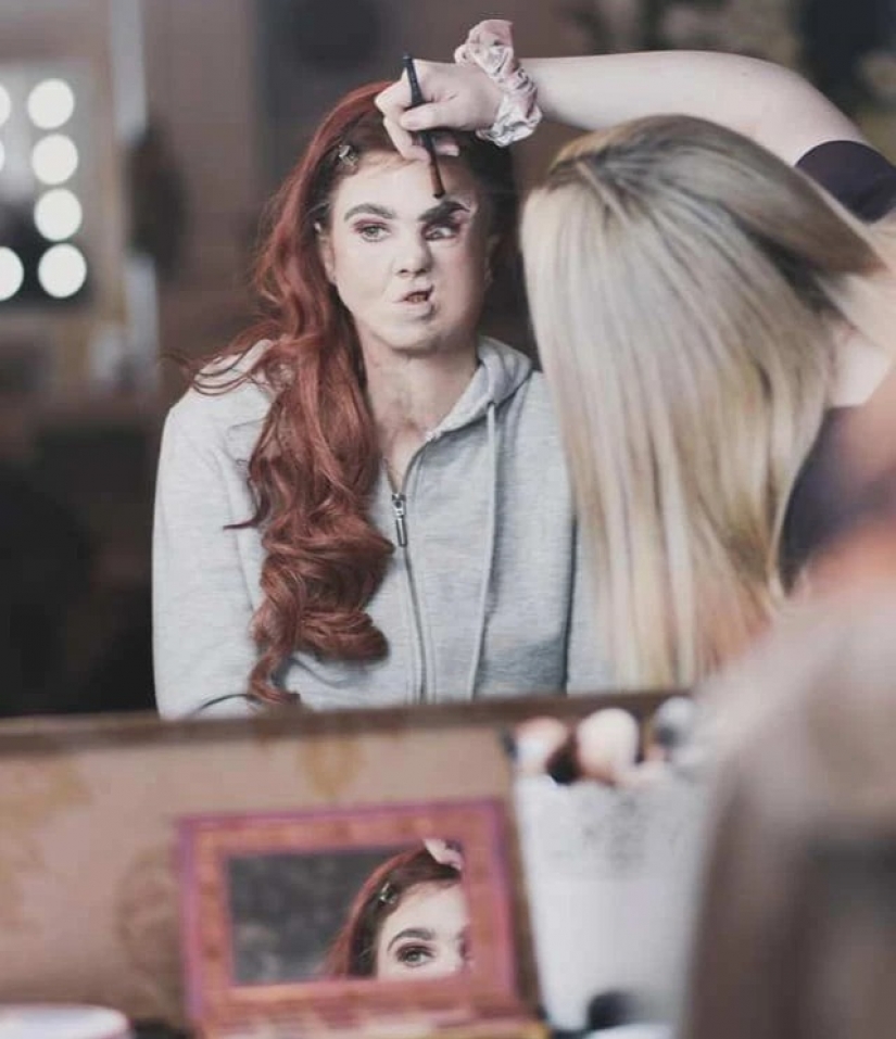 El amor mira al corazón: cómo una mujer irlandesa con el rostro desfigurado encontró su felicidad femenina