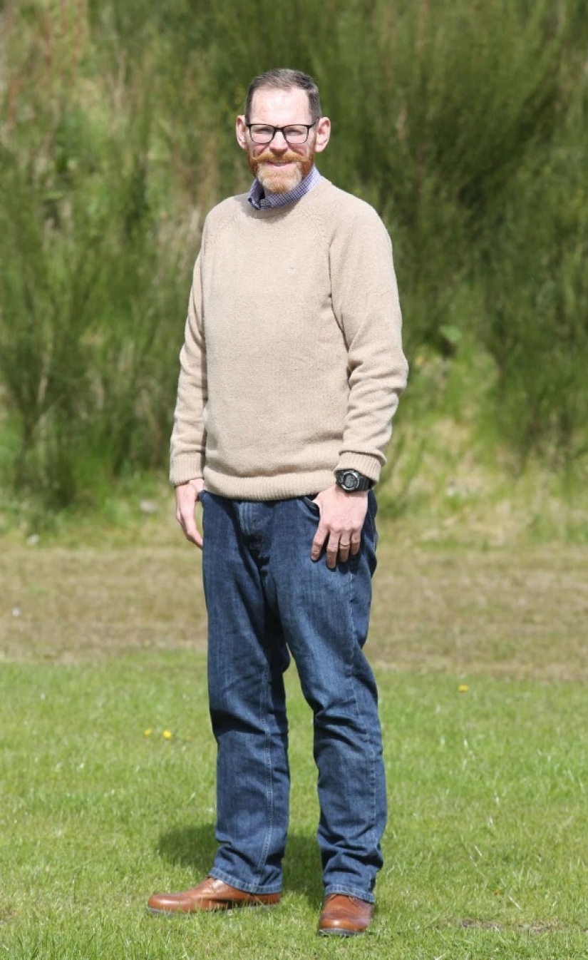 El británico más gordo perdió 270 kg porque tenía miedo de aplastar a su esposa en la cama El británico más gordo perdió 270 kg porque tenía miedo de aplastar a su esposa en la cama