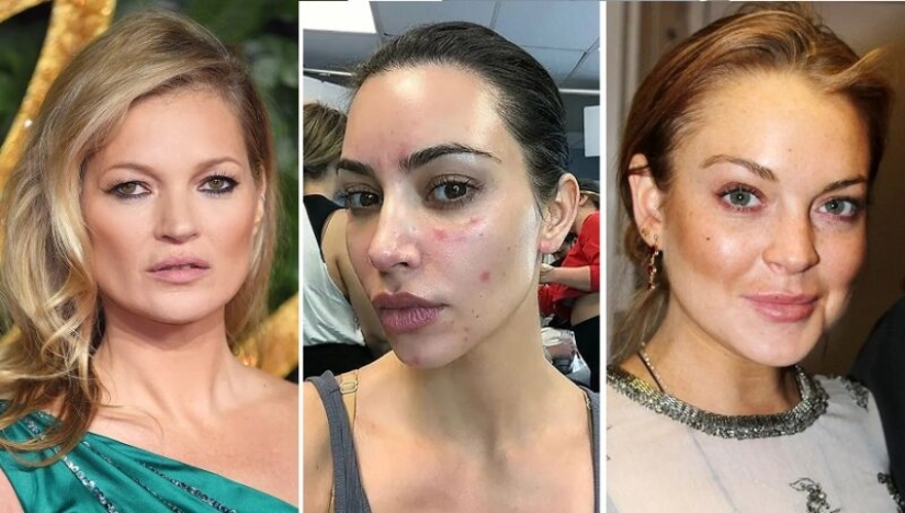 El entrecerrado de Kate Moss y 7 características más que las estrellas no nos ocultan