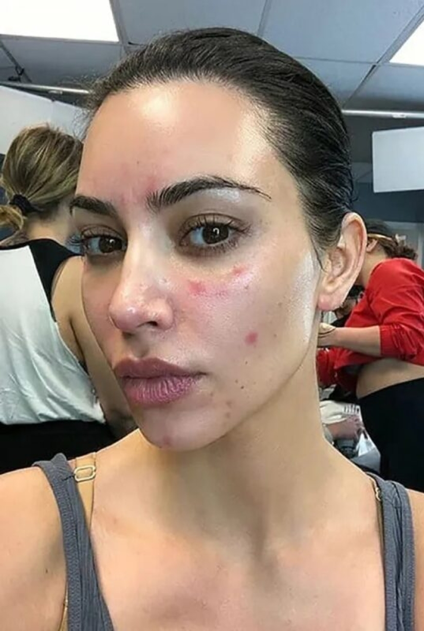 El entrecerrado de Kate Moss y 7 características más que las estrellas no nos ocultan