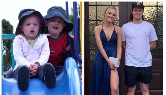 El hermano gemelo nació dos años antes que su hermana. ¿Cómo es esto posible?