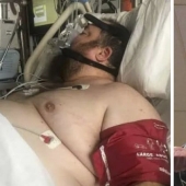 El hombre se decepcionó tanto que casi murió, pero la dieta y los deportes lo salvaron y lo hicieron guapo