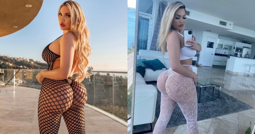 El modelo delgado aumentó las nalgas y luego amargamente lo lamentó El modelo delgado aumentó las nalgas y luego amargamente lo lamentó