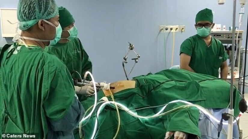 El más gordo de chico en el mundo perdió más allá del reconocimiento: así se ve ahora